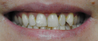 sourire1a-1