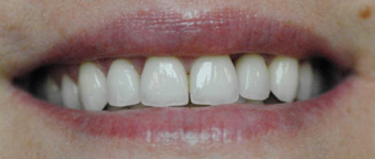 sourire1b-1