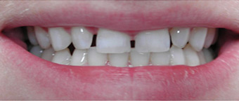 sourire6a