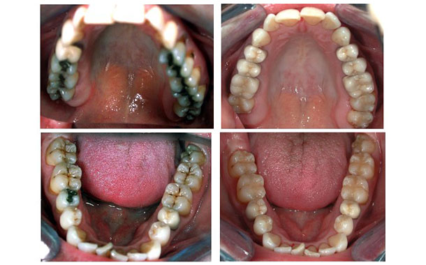 traitement4